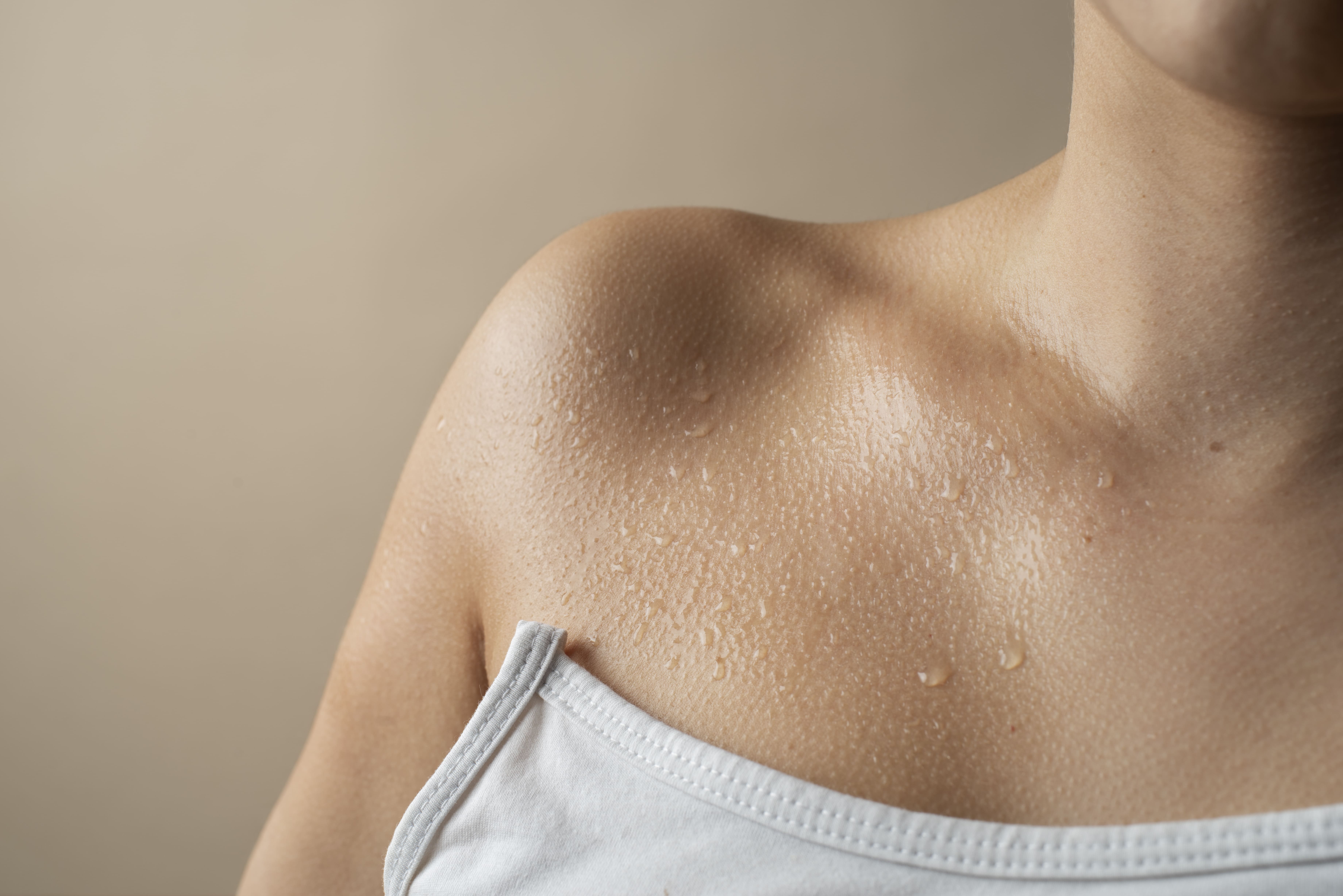 Hiperhidrosis
